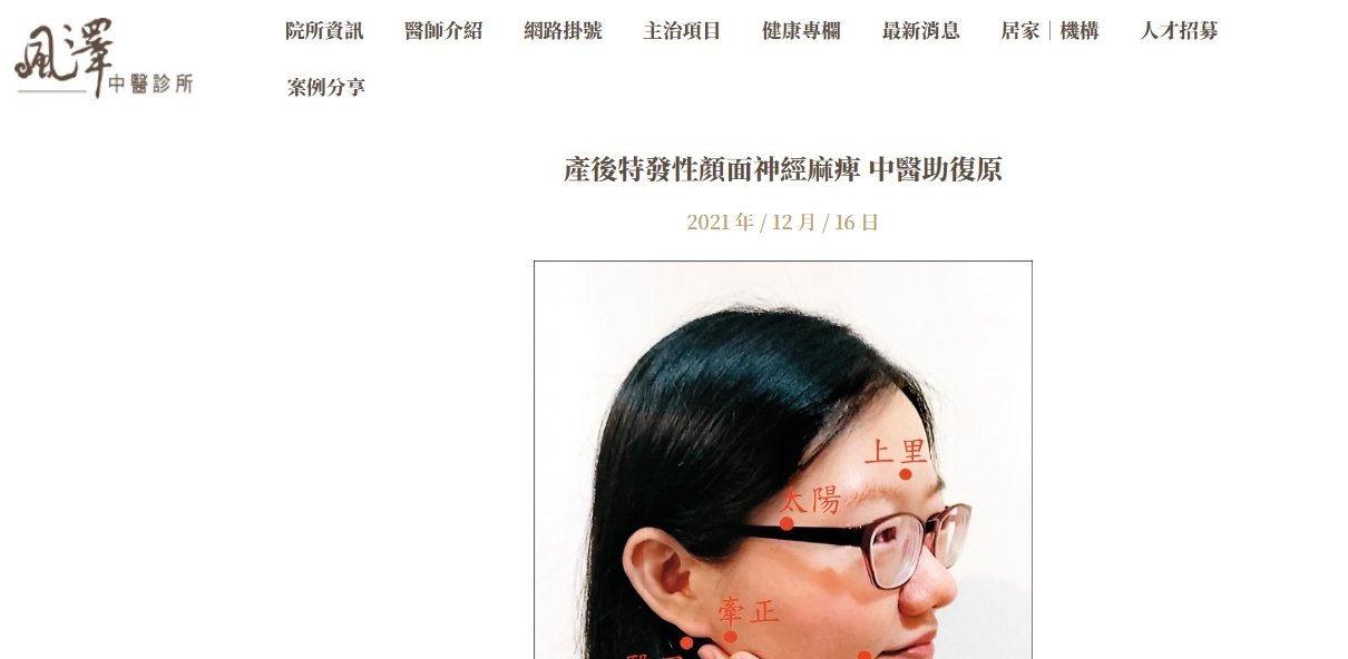 風澤中醫診所-產後特發性顏面神經麻痺 中醫助復原