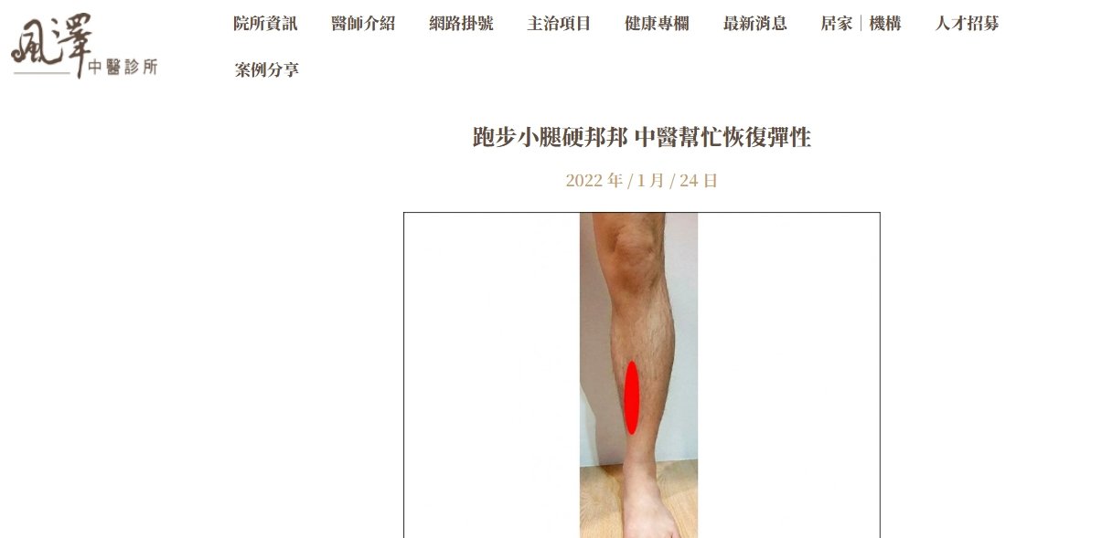 風澤中醫診所-跑步小腿硬邦邦 中醫幫忙恢復彈性