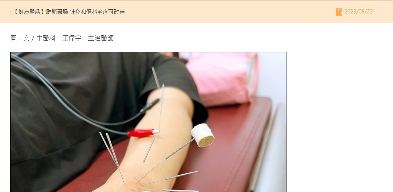 鹿港基督教-腱鞘囊腫 針灸和傷科治療可改善