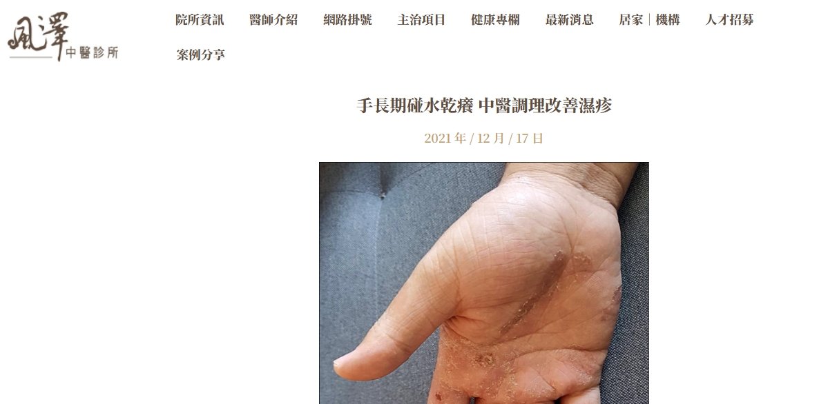 風澤中醫診所-手長期碰水乾癢 中醫調理改善濕疹