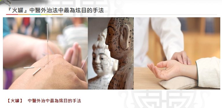 美德中醫醫院-『火罐』中醫外治法中最為炫目的手法