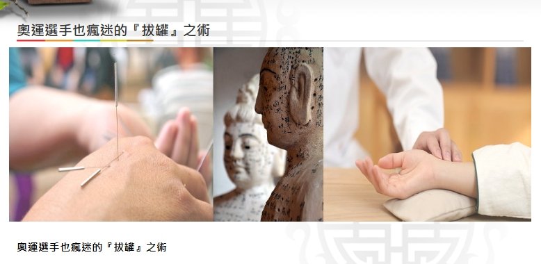 美德中醫醫院-奧運選手也瘋迷的『拔罐』之術