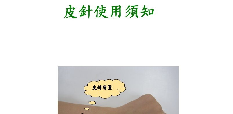 大里仁愛醫院-皮針使用須知