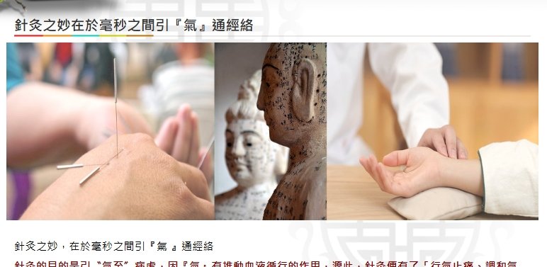 美德中醫醫院-針灸之妙在於毫秒之間引『氣』通經絡